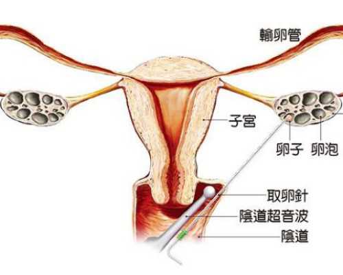 浙江高效的代孕网,本人多囊，在衢州试管是去浙江衢化医院还是江山人民医院